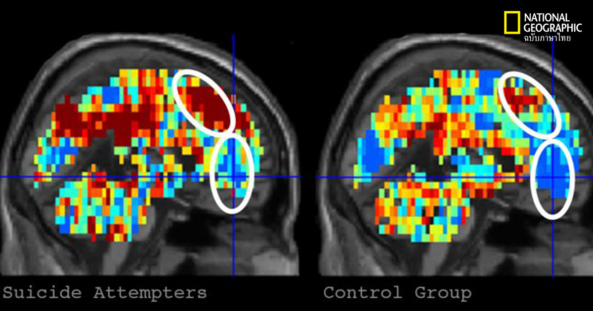 ฆ่าตัวตาย