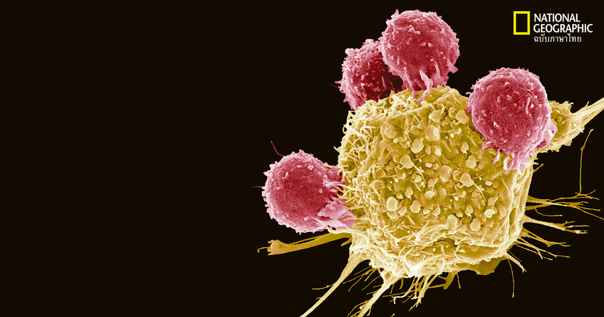 เซลล์มะเร็ง