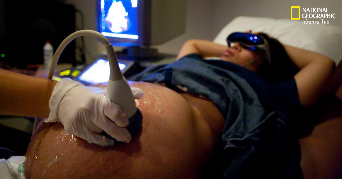 แค่ตรวจเลือดก็รู้ได้ว่าจะคลอดก่อนกำหนดหรือไม่