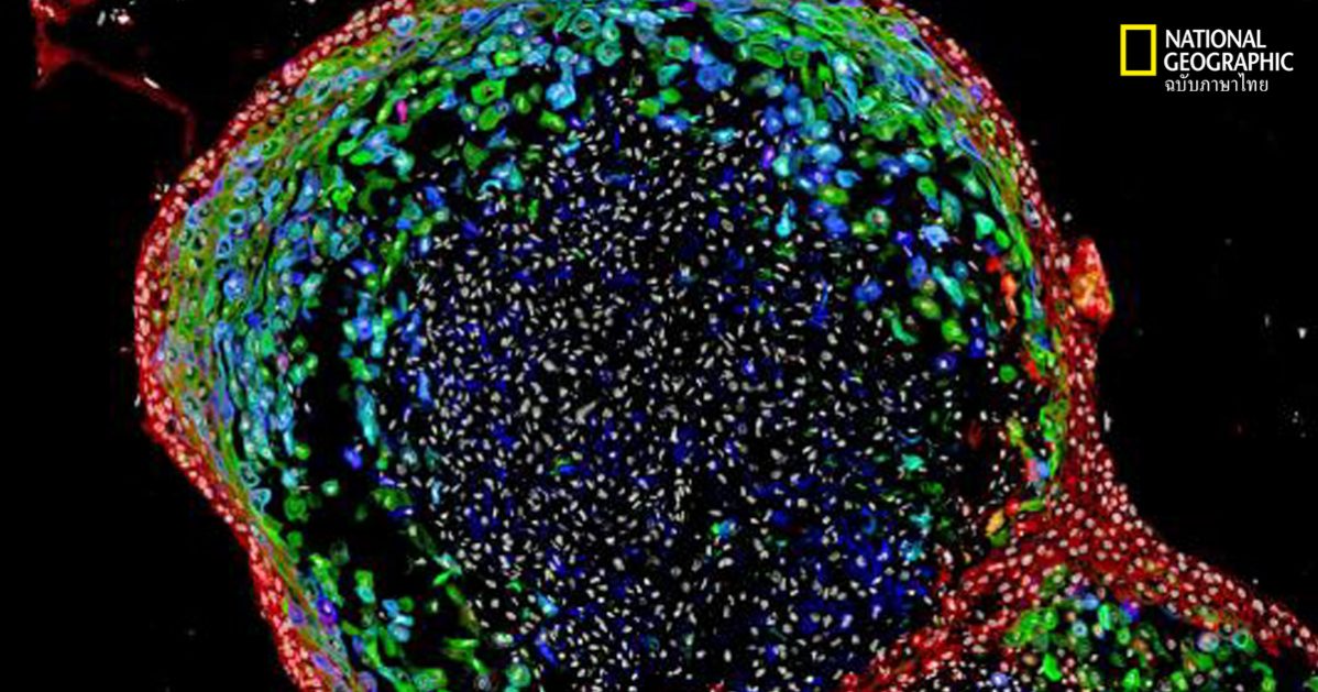 หลอดอาหาร